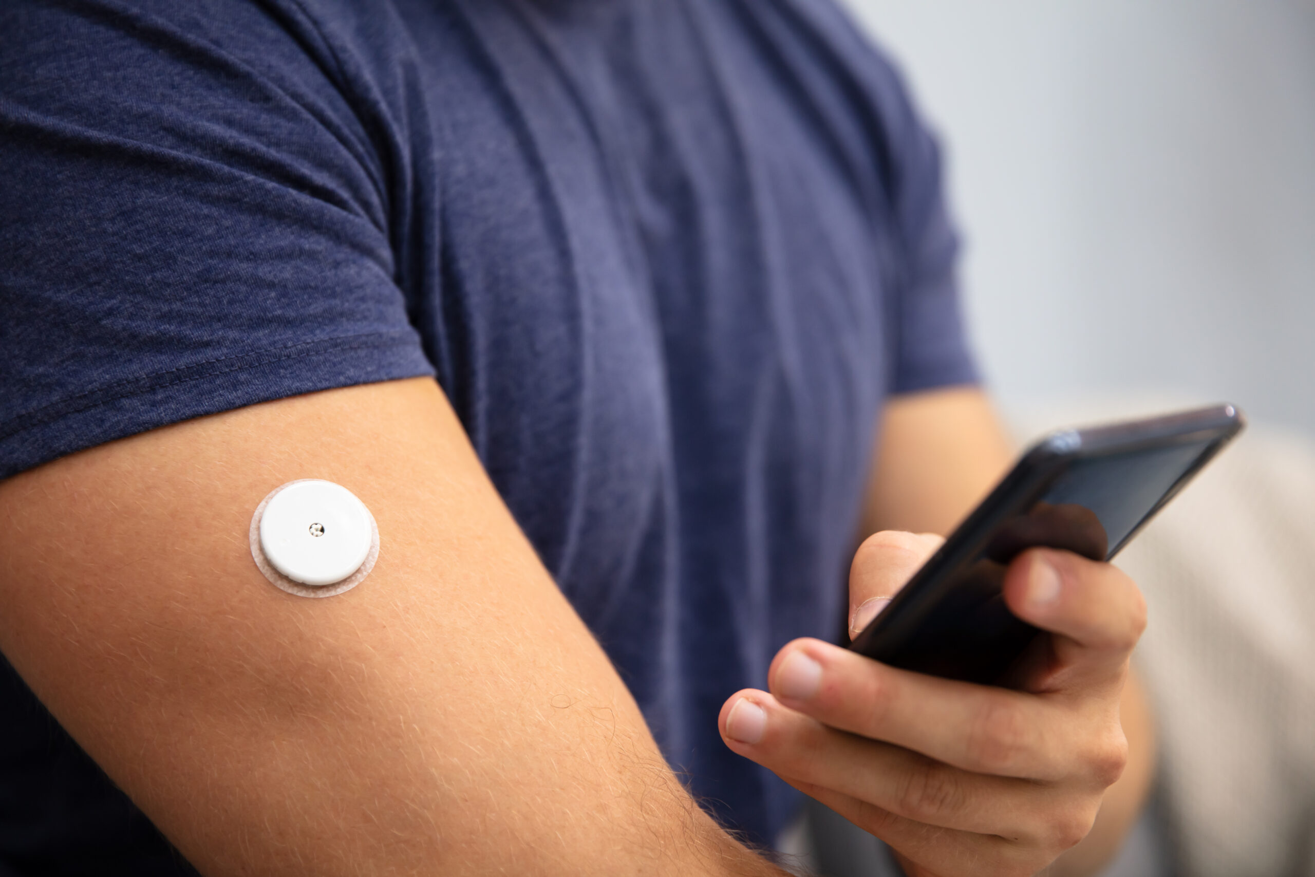 What’s trending: Continuous Glucose Monitoring